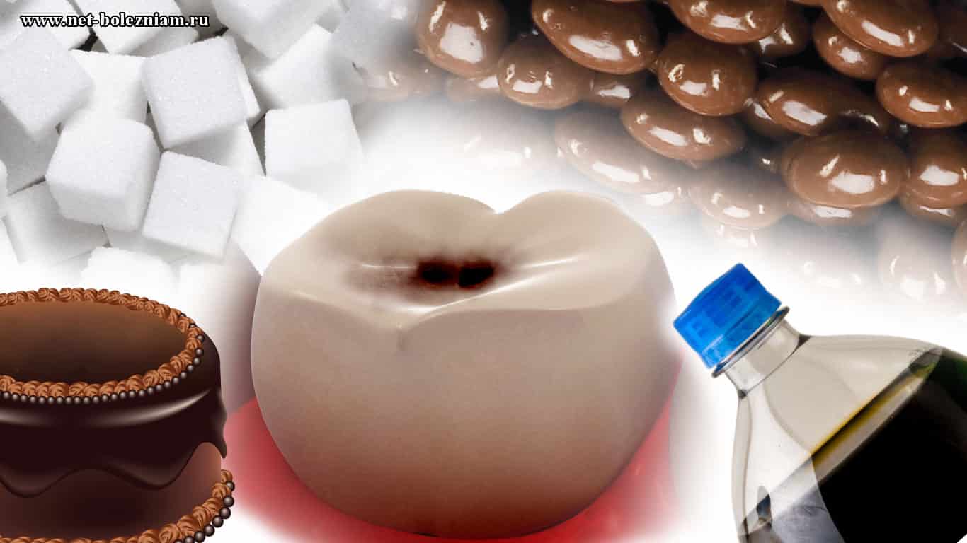 Кариес молочных зубов и его причины