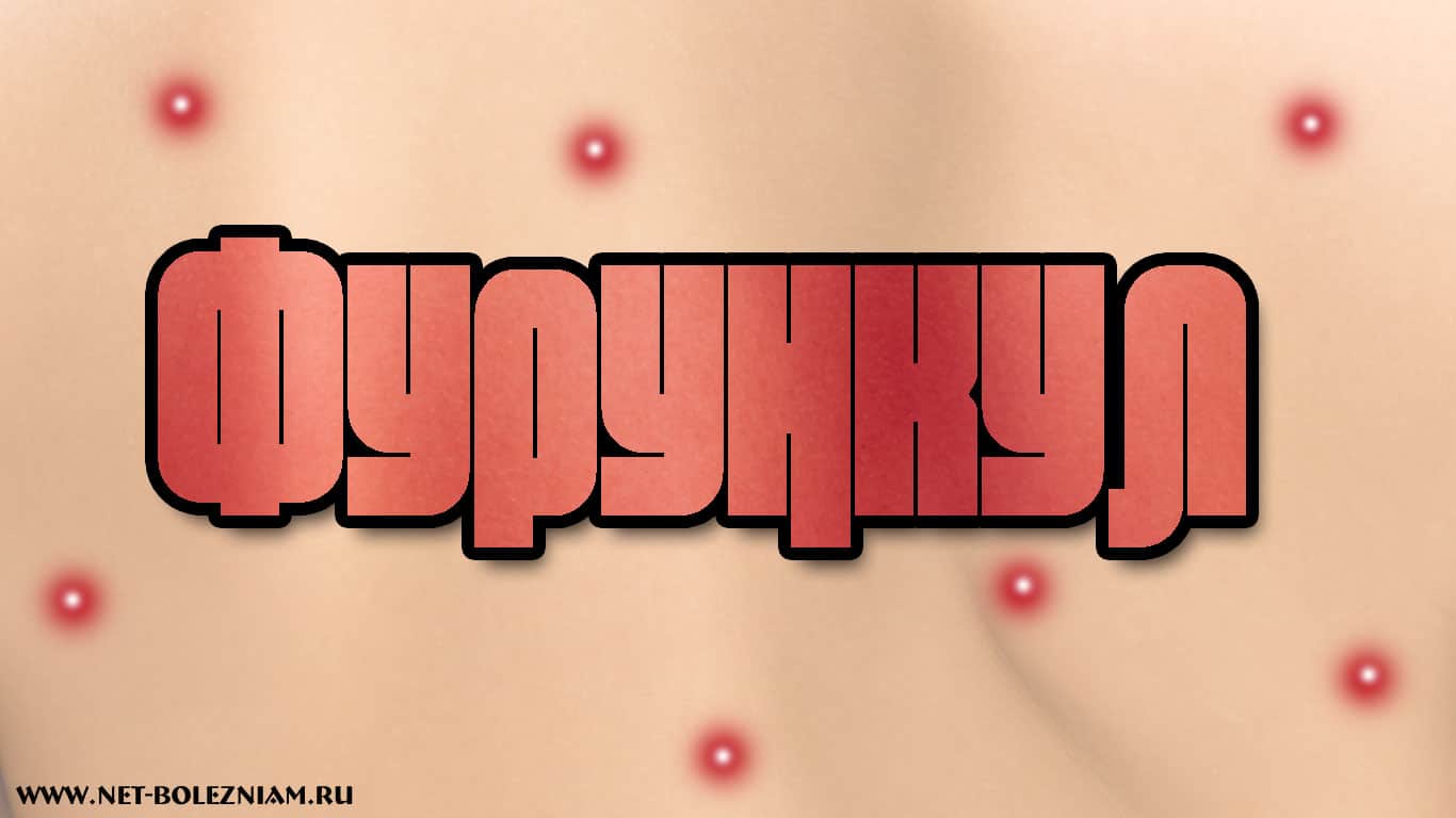 В начале фурункул - красноватого цвета и болезненный при пальпации. Через 1 - 1,5 недель под кожей накапливается гной, от этого центр фурункула становится белым.
