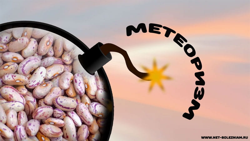 Что такое метеоризм?