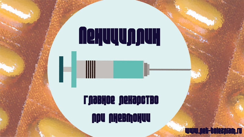 Пенициллин - главное лекарство при пневмонии.